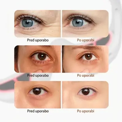 EyeGlow™ očala za nego oči s svetlobno terapijo